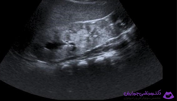 کاربرد سونوگرافی