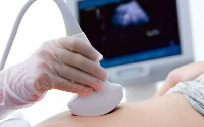 سونوگرافی در اهواز