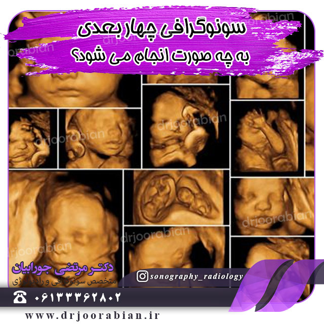 سونوگرافی چهاربعدی جنین لازم است؟