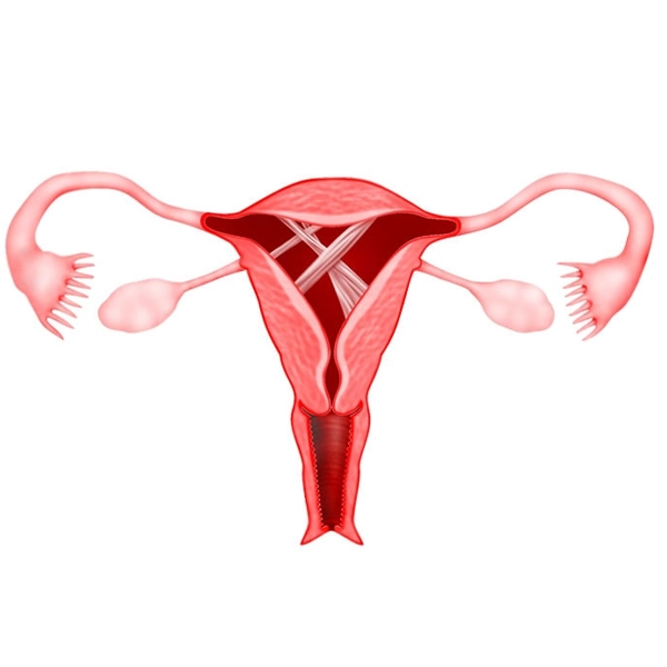 تشخیص چسبندگی رحم با سونوگرافی