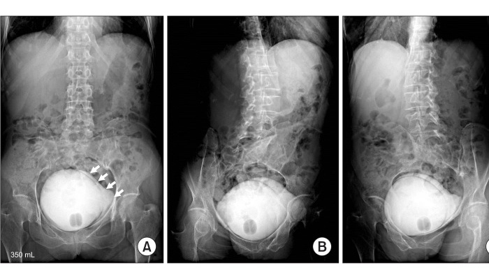 سیستواورتروگرام
