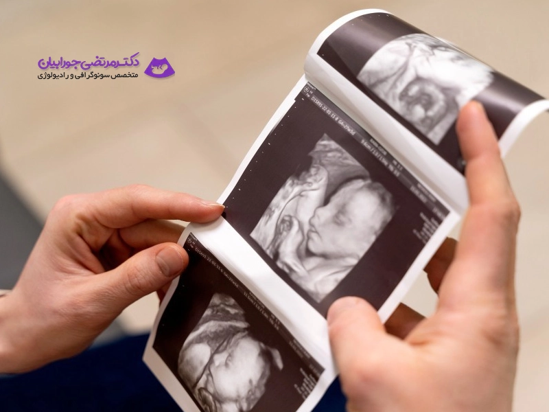 چگونگی انجام سونوگرافی آنومالی